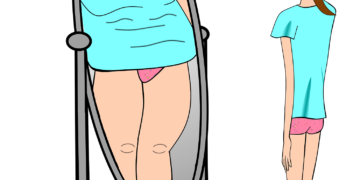 مرض فقدان الشهية العصابي أو القهم العصابي  والنحافة الشديدة